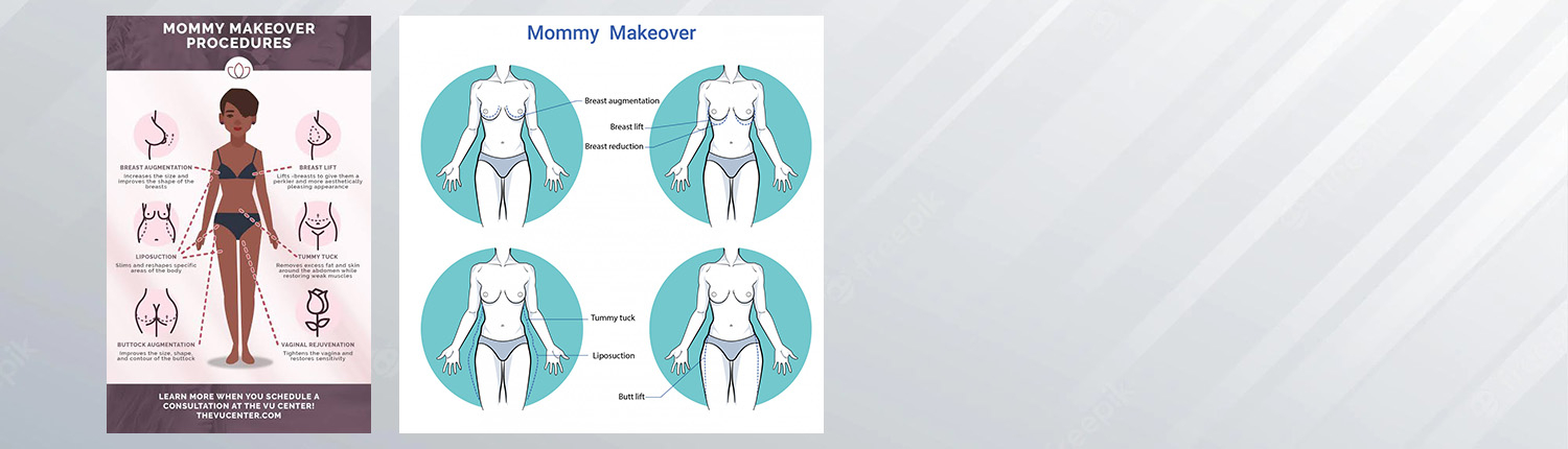 Mommy Makeover (Annelik Estetiği), Rhinoplasty (Burun Estetiği), Facelift (Yüz Germe), Liposuction (Yağ Alma), Breast Augmentation (Meme Büyütme), Breast Lift (Meme Kaldırma)